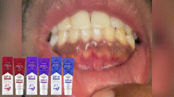 120g Probiotic Toothpaste SP-7 Whitens Teeth Removes Yellow Stains Tooth Whitening Agent Oral Hygiene Cleans and Freshens Breath