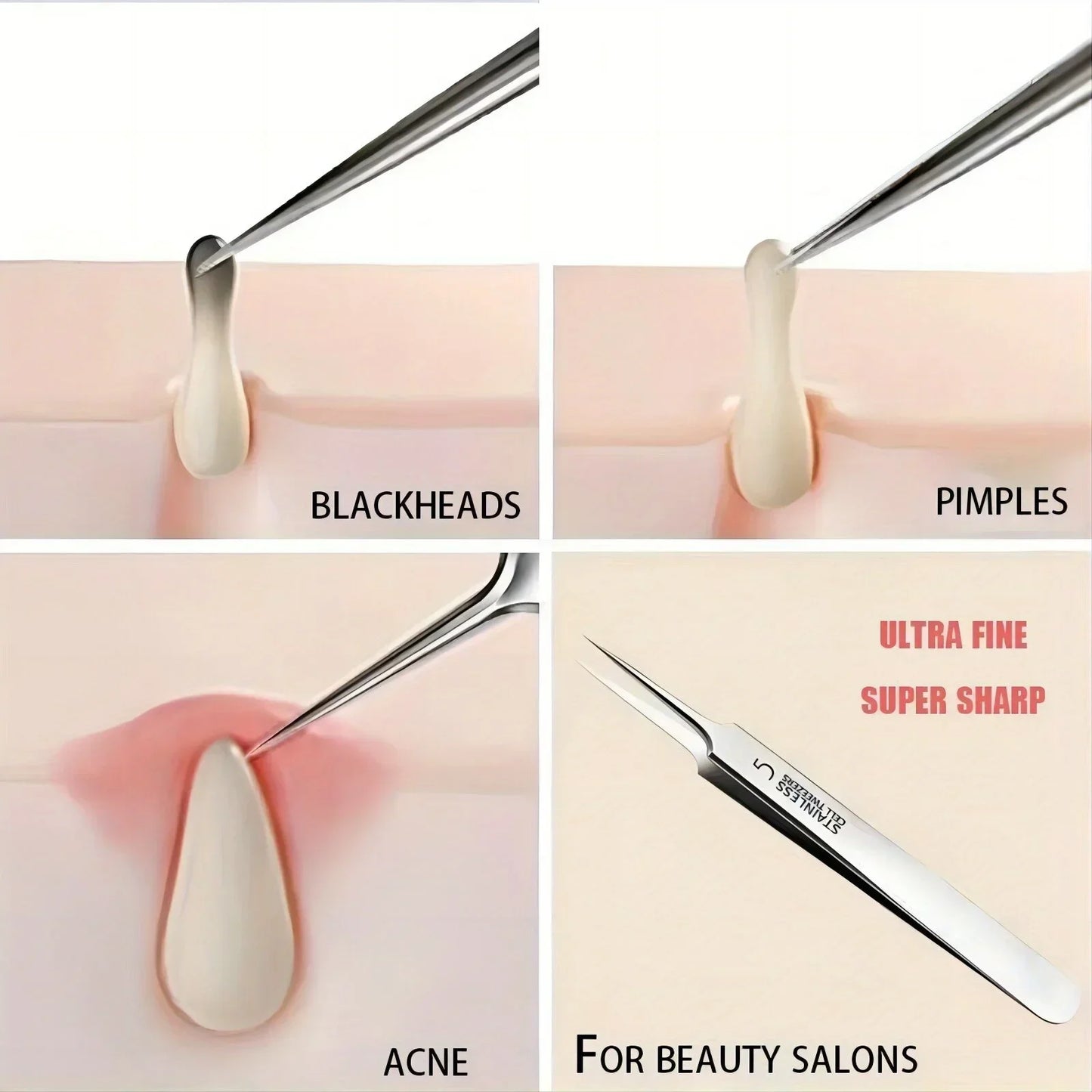 1 Pack Extra Fine No. 5 Cellular Acne Blackhead Tweezers - Facial Beauty Remove Acne Needle