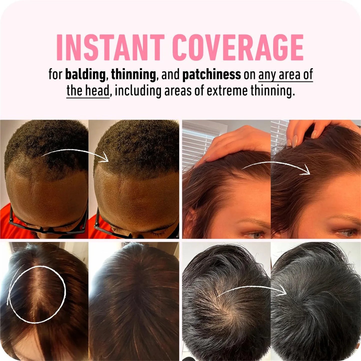 Powder Instantly Conceals Hair Loss, Root  Up Hair Powder, Hair Toppers For Women & Men, Hair Fibers For Thinning Hair, Gift