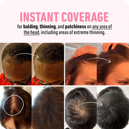 Powder Instantly Conceals Hair Loss, Root  Up Hair Powder, Hair Toppers For Women & Men, Hair Fibers For Thinning Hair, Gift
